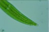 Closterium moniliferum