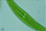 Closterium moniliferum