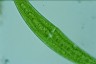 Closterium moniliferum