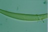 Closterium rostratum