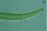 Closterium rostratum