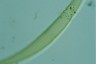 Closterium rostratum