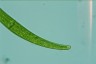 Closterium rostratum