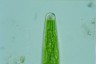 Closterium baillyanum