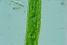 Closterium baillyanum