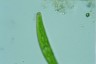 Closterium intermedium