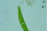 Closterium intermedium