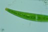 Closterium striolatum