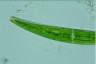 Closterium striolatum