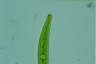 Closterium intermedium