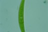 Closterium intermedium