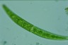 Closterium intermedium