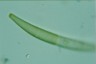 Closterium intermedium