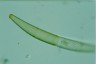 Closterium intermedium