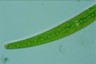 Closterium intermedium