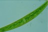 Closterium intermedium