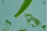 Closterium intermedium