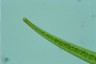 Closterium ralfsii