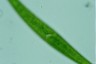 Closterium ralfsii