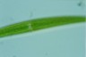 Closterium ralfsii