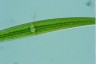 Closterium ralfsii