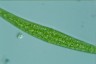 Closterium ralfsii