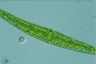 Closterium ralfsii