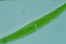 Closterium ralfsii