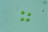 Asterococcus superbus