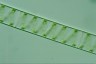 Spirogyra