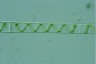 Spirogyra