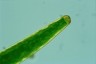 Closterium baillyanum