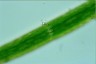 Closterium baillyanum