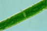 Closterium baillyanum