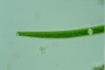 Closterium angustatum