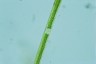 Closterium gracile