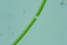 Closterium toxon