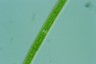 Closterium ulna