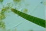 Closterium turgidum