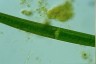 Closterium turgidum