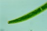 Closterium baillyanum