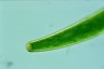 Closterium baillyanum