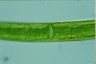 Closterium baillyanum