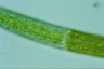 Closterium baillyanum