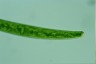 Closterium baillyanum