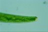 Closterium baillyanum