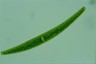 Closterium striolatum