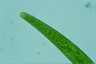 Closterium striolatum