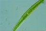 Closterium intermedium