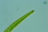 Closterium intermedium